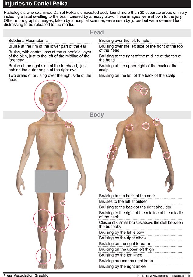 Tiêu điểm - Bé bị mẹ ruột và dượng ép ăn muối, ngâm nước đến chết (Hình 4).