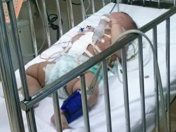 Miền bắc - Hà Nội: Bé gái 4 tháng tuổi bị đâm vào bụng