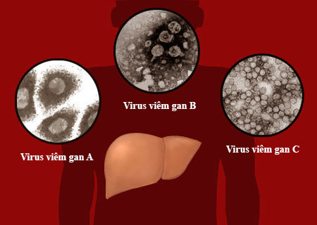 Các bệnh - Những nguy hiểm khi bị viêm gan B, C, viêm túi mật  (Hình 2).