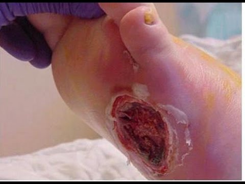 C&aacute;c bệnh - 3 th&oacute;i quen xấu khiến tay ch&acirc;n bị hủy hoại v&agrave; biến dạng khủng khiếp (H&igrave;nh 9).