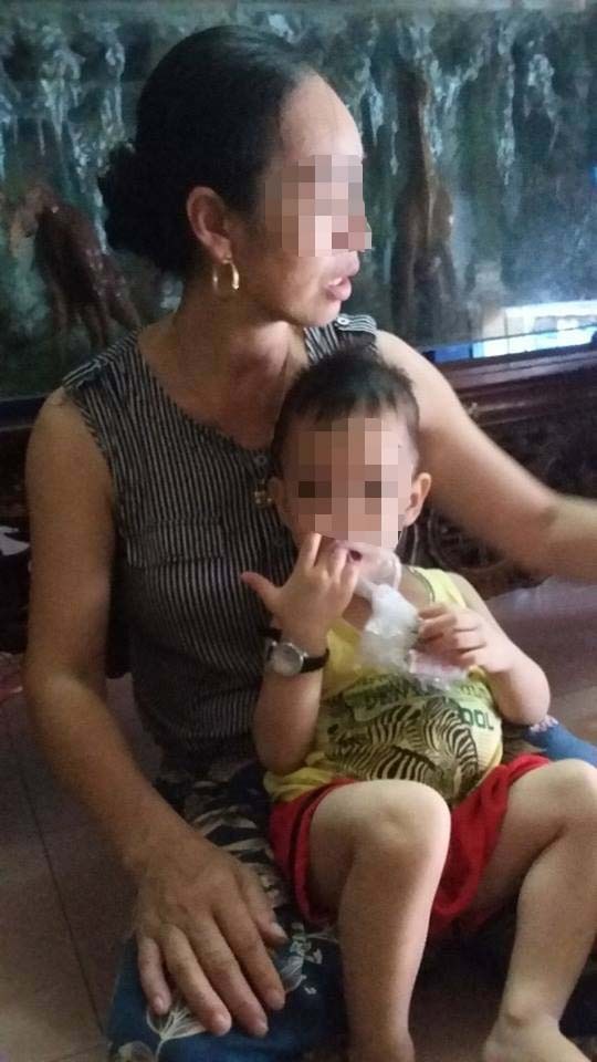 Dân sinh - Sự thật câu chuyện tập thể gia đình nhà chồng đánh con dâu nhập viện (Hình 2).