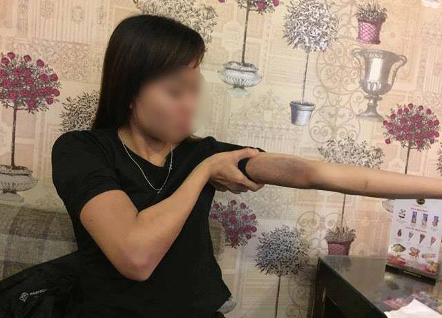 Hồ sơ điều tra - Hà Nội: Lời kể hãi hùng của cô gái bị bạn trai đánh đập dã man