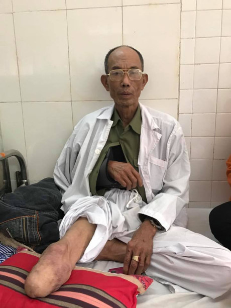 Hồ sơ điều tra - Đề nghị truy tố các đối tượng hành hung người thương binh cụt chân