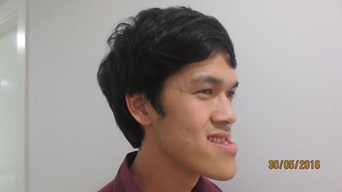 T&acirc;m sự - Bức t&acirc;m thư tạo n&ecirc;n kỳ t&iacute;ch cho ch&agrave;ng trai c&oacute; gương mặt lưỡi liềm