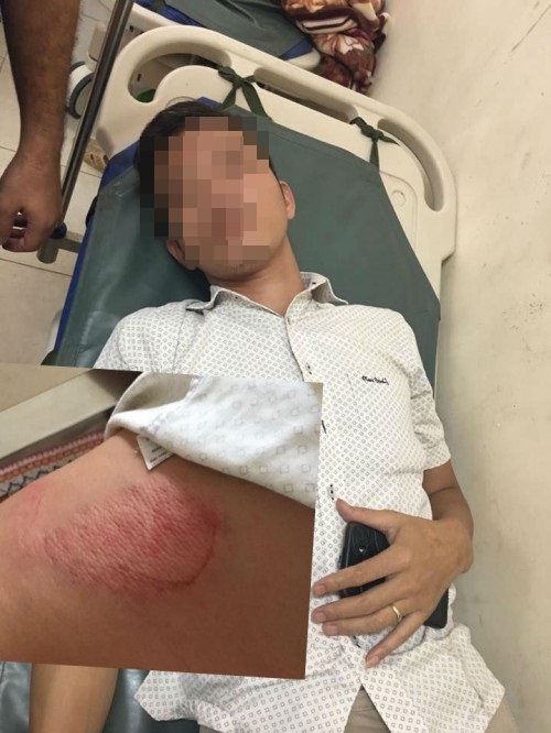 An ninh - Hình sự - Va chạm giao giao thông, một phóng viên bị đánh nhập viện