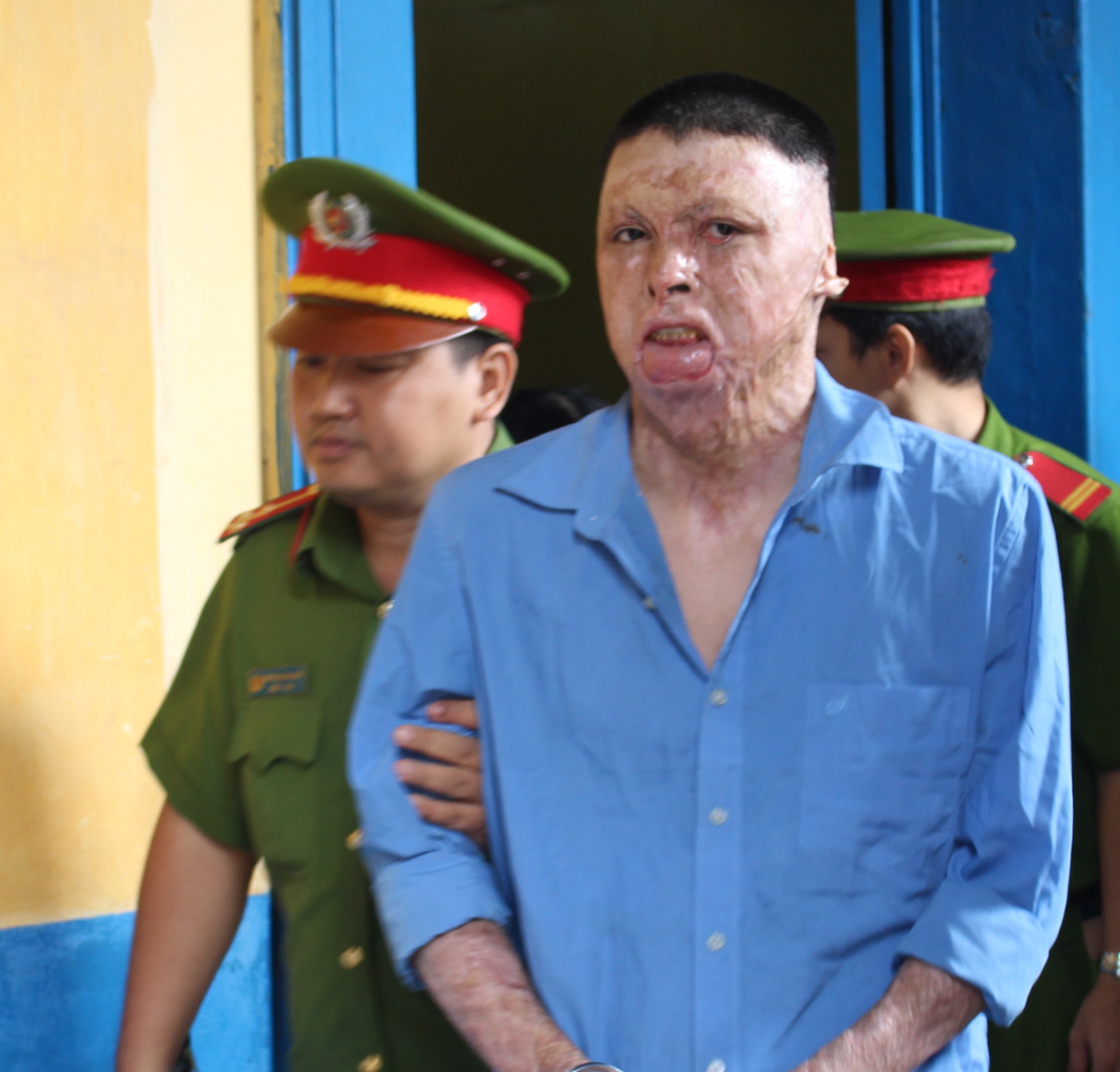 Hồ sơ điều tra - Kh&ocirc;ng tăng &aacute;n với g&atilde; &lsquo;phi c&ocirc;ng trẻ&rsquo; tưới xăng đốt nh&acirc;n t&igrave;nh
