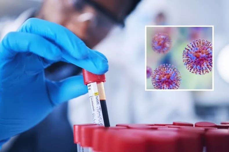 Sau 2 năm sự cố xảy ra, Úc thừa nhận làm mất hơn 300 lọ mẫu virus gây chết người
- Ảnh 1. Sau 2 năm sự cố xảy ra, Úc thừa nhận làm mất hơn 300 lọ mẫu virus gây chết người
- Ảnh 1.