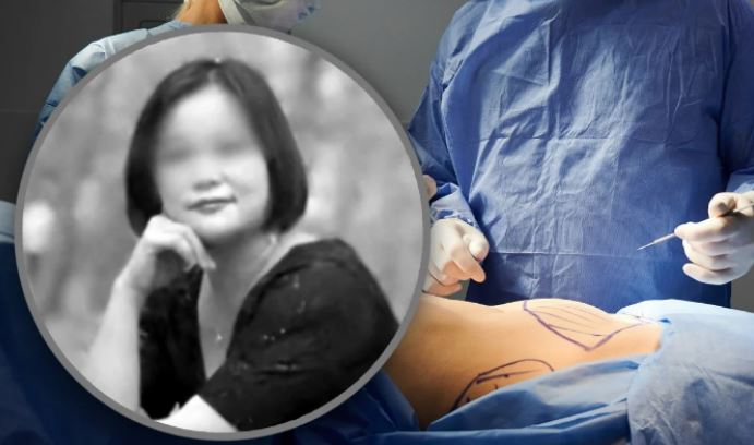 Thực hiện liên tục 6 ca phẫu thuật thẩm mỹ trong 24 giờ, người phụ nữ tử vong- Ảnh 1.