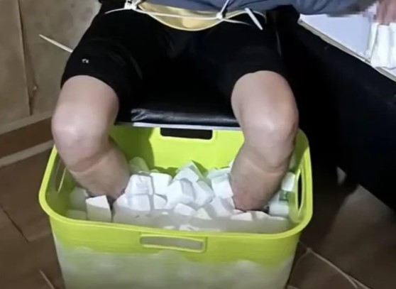 Nam thanh niên ngâm chân trong đá khô, tự hủy 2 chân vì lý do không ngờ- Ảnh 1.