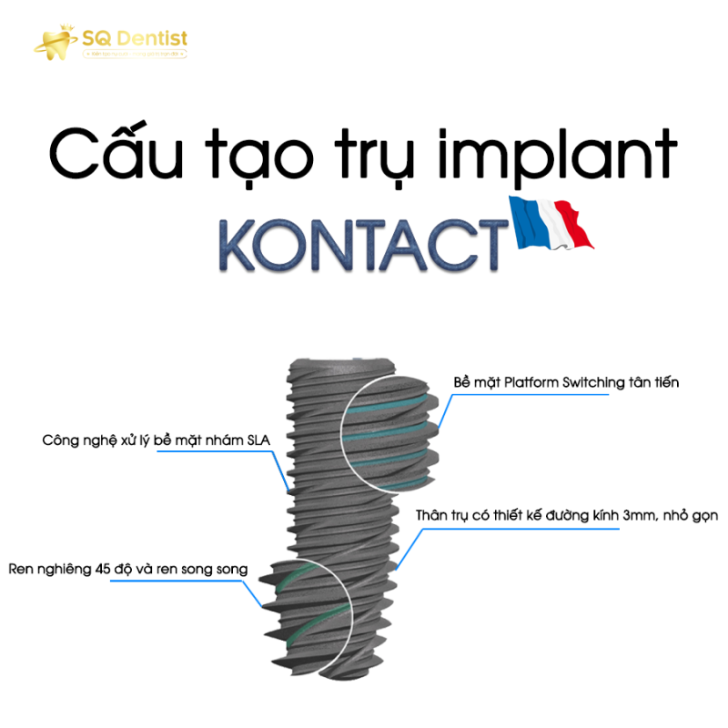 SQ Dentist - Dịch vụ trồng răng implant tốt tại TPHCM- Ảnh 2.