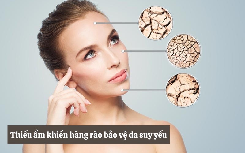 Tại sao cần phải dưỡng ẩm da mặt hàng ngày?- Ảnh 3.