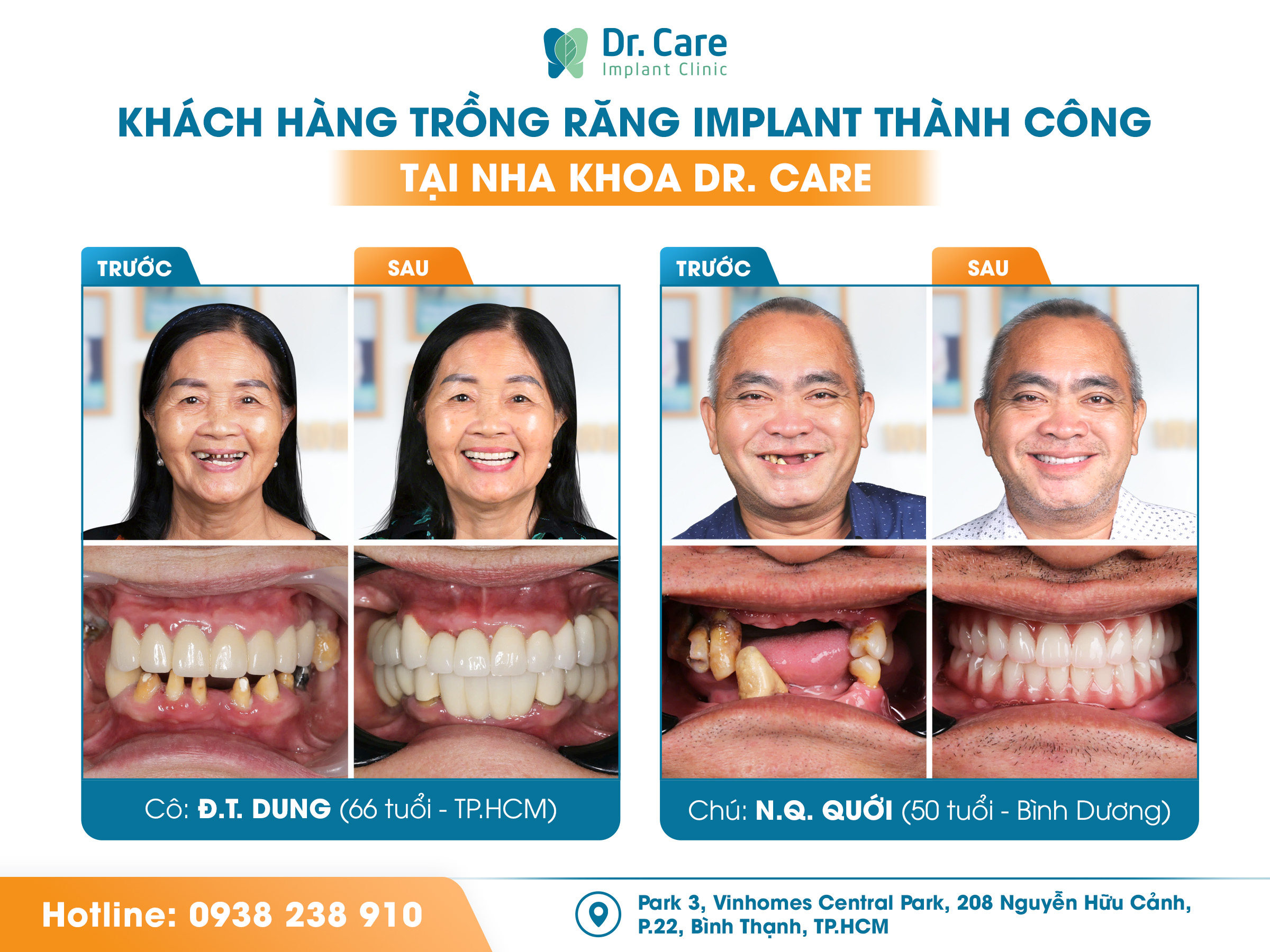 Dr. Care: Nha khoa tiên phong ứng dụng công nghệ cao trong trồng răng Implant- Ảnh 5.