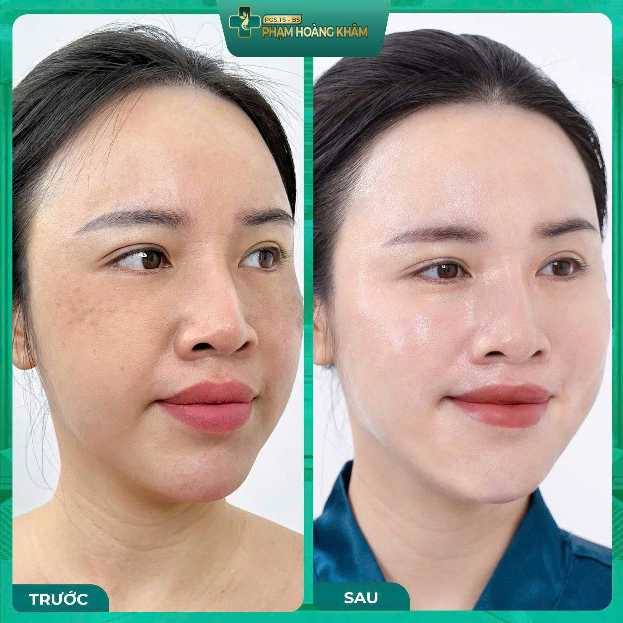 Bí quyết làn da khỏe đẹp chuẩn y khoa từ Phòng khám Da liễu 42 Liễu Giai - Ảnh 3.