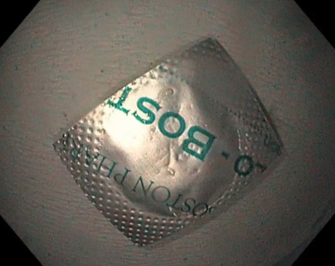 Người đàn ông 52 tuổi nhập viện trong tình trạng đau bụng, bác sĩ phát hiện lý do "đáng sợ" phía sau- Ảnh 1. Người đàn ông 52 tuổi nhập viện trong tình trạng đau bụng, bác sĩ phát hiện lý do "đáng sợ" phía sau- Ảnh 1.