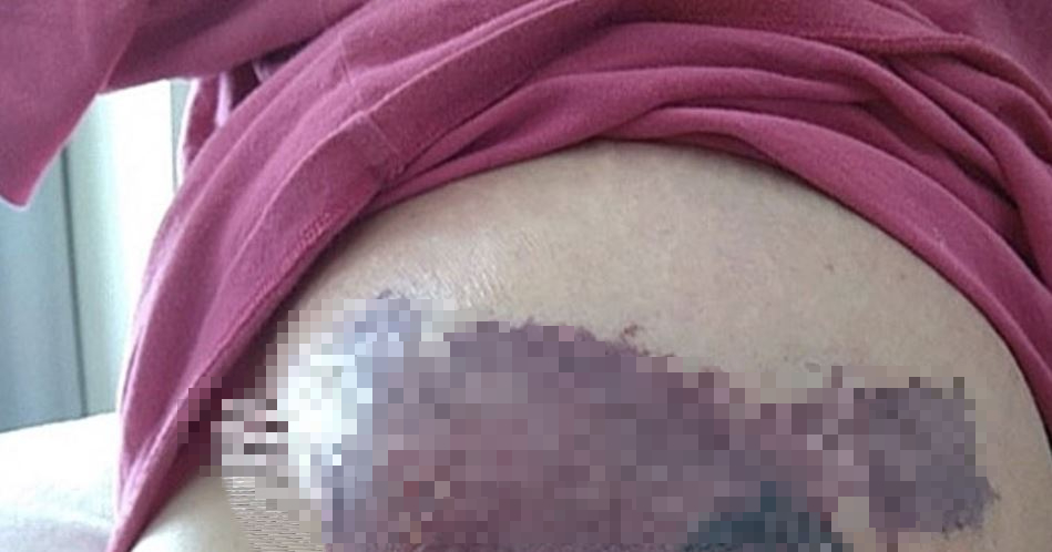 Người phụ nữ mới sinh ngực đột ngột chuyển màu đen, bác sĩ sốc nặng khi phát hiện "bí mật" đáng sợ - Ảnh 1.