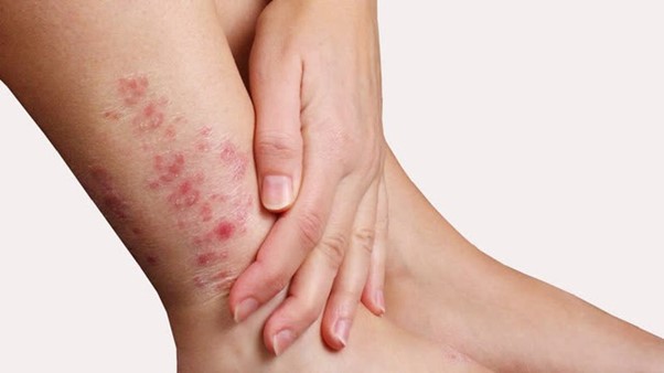 Sau khi lội nước ngập do mưa bão, khi về nhà cần làm luôn những việc này để bảo vệ sức khỏe - Ảnh 6.