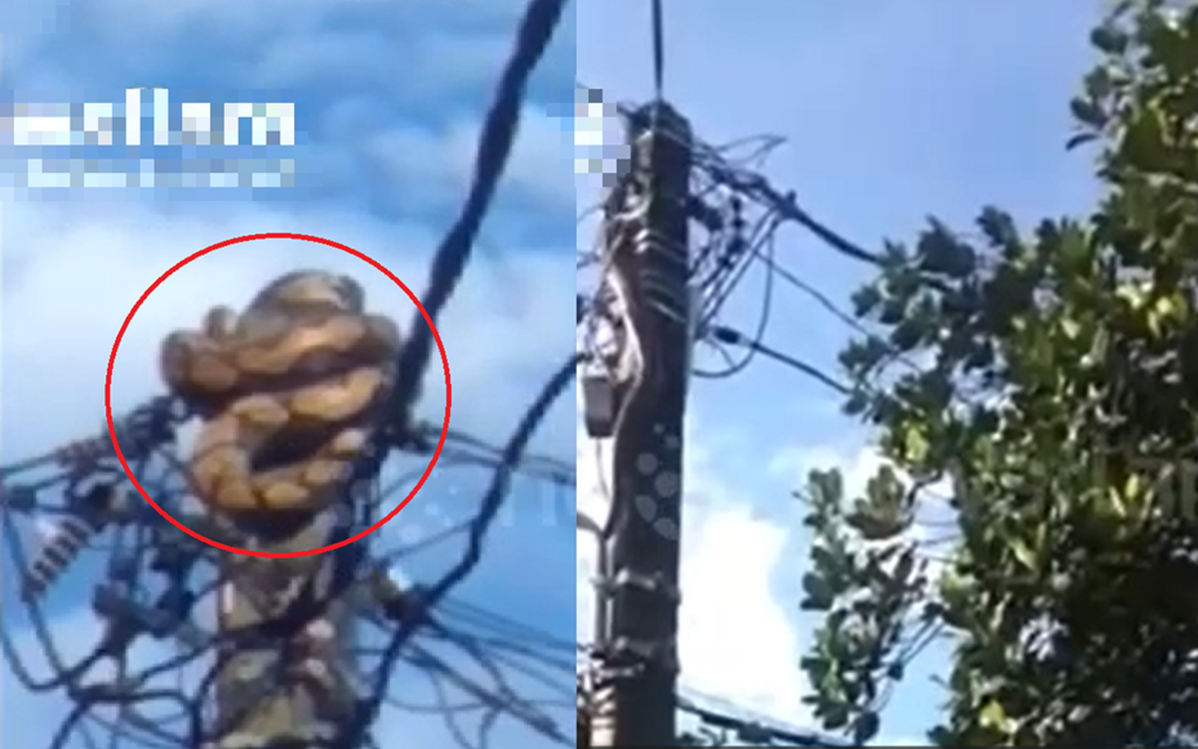 Người phụ nữ 48 tuổi đau tai dữ dội, bác sĩ gắp ra "thứ đáng sợ" bên trong- Ảnh 2. Người phụ nữ 48 tuổi đau tai dữ dội, bác sĩ gắp ra "thứ đáng sợ" bên trong- Ảnh 2.