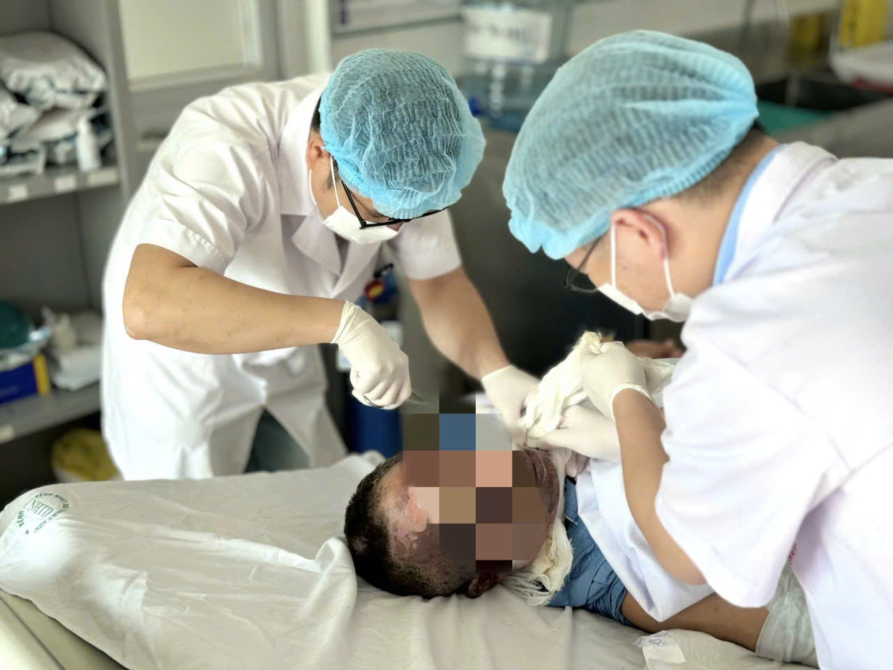 Giữ thang giúp hàng xóm, người đàn ông nhập viện với 30% cơ thể bỏng rộp - Ảnh 2.