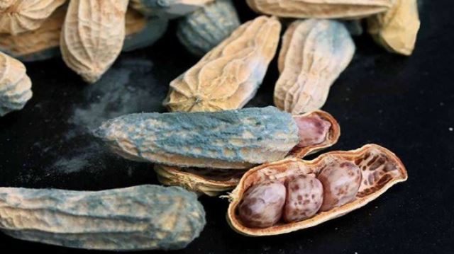 Ăn món này mỗi sáng suốt 20 năm, người phụ nữ sốc nặng khi biết mắc ung thư gan - Ảnh 2.