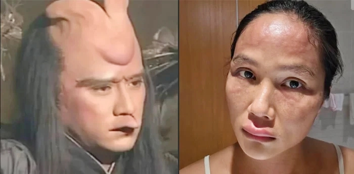 Hoa hậu H'hen Niê tiết lộ căn bệnh mà cô mắc phải sau sinh - Ảnh 2.