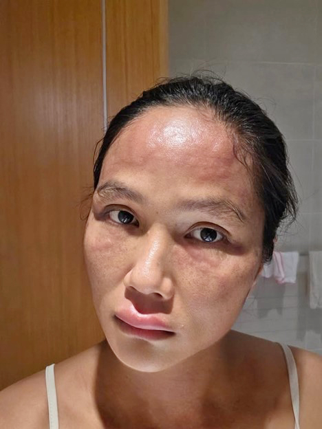 Hoa hậu H'hen Niê tiết lộ căn bệnh mà cô mắc phải sau sinh - Ảnh 1.