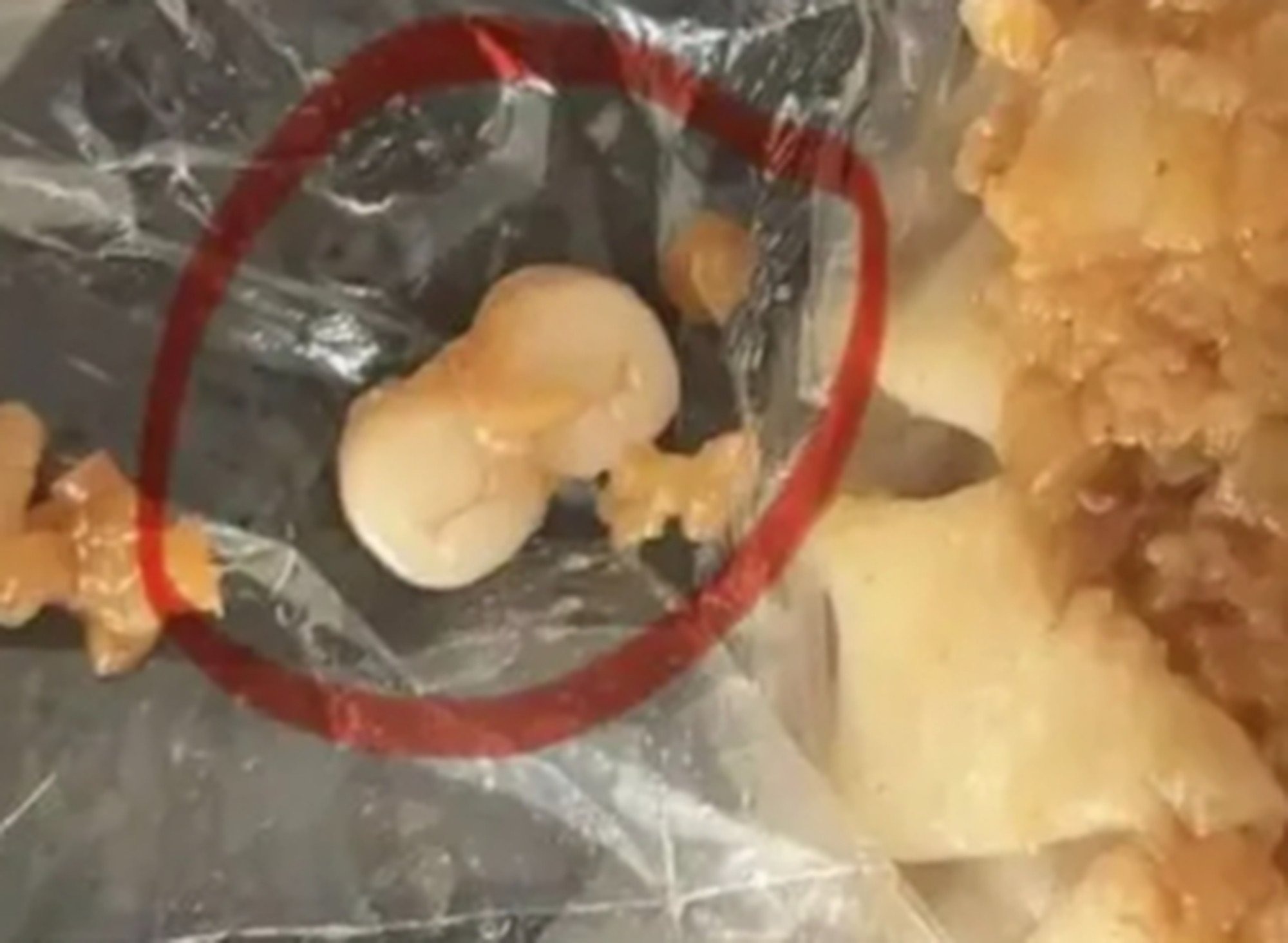 Người dân sốc nặng khi phát hiện răng người trong xúc xích, dimsum- Ảnh 2. Người dân sốc nặng khi phát hiện răng người trong xúc xích, dimsum- Ảnh 2.