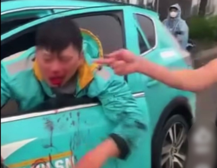 Tài xế xe ôm bị đấm tới tấp vào đầu ở Hà Nội - Ảnh 2.