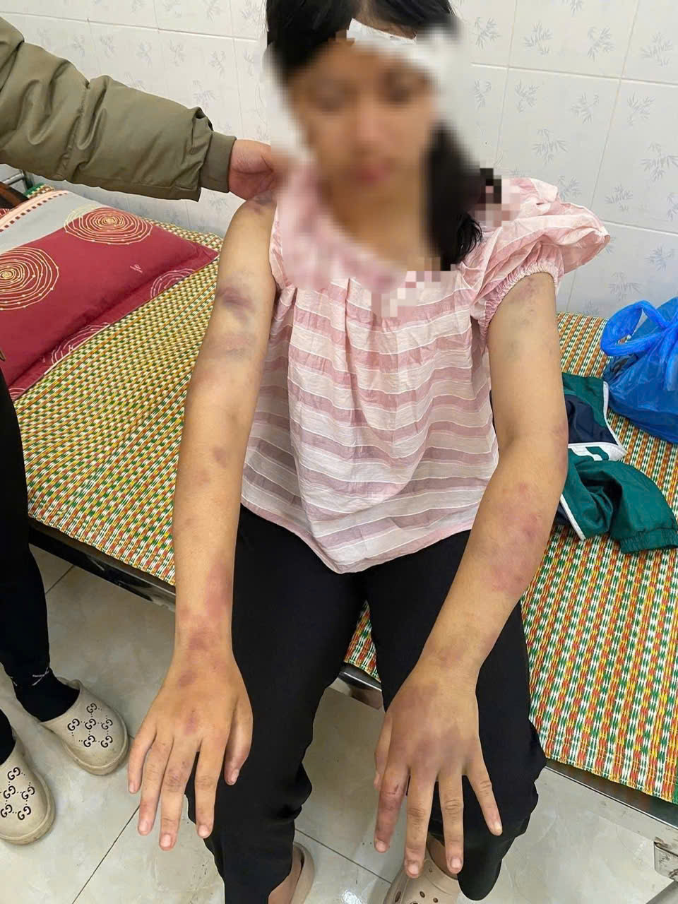 Bé gái 13 tuổi bị bà nội và hai người ông đánh đập vì nghi trộm tiền - Ảnh 1.