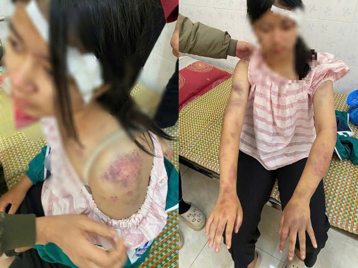 Góc nhìn pháp lý vụ bà nội cùng 2 đồng phạm tra tấn tàn nhẫn cháu ruột suốt nhiều tiếng đồng hồ- Ảnh 2.