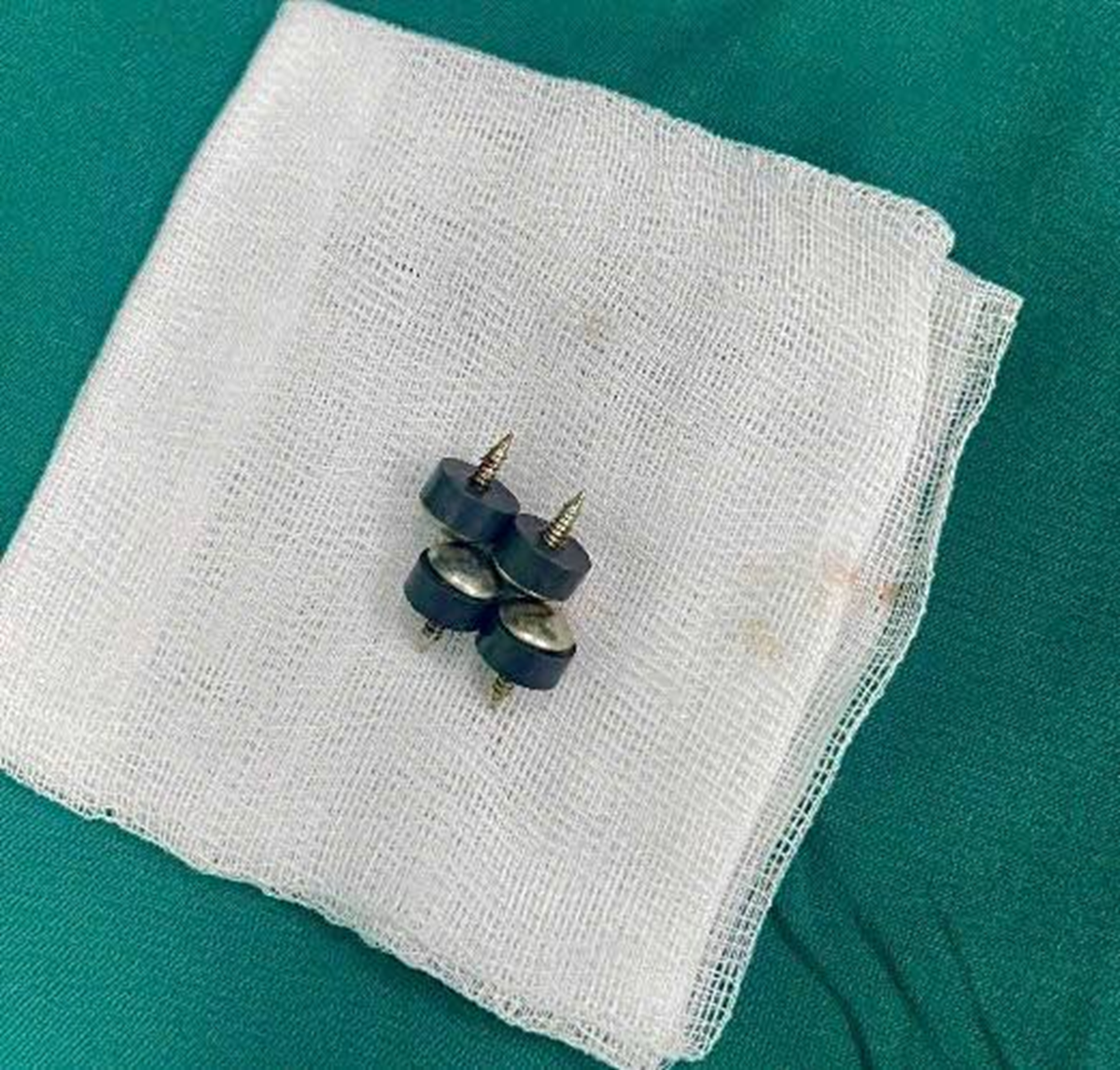 Bé trai 2 tuổi được gia đình đưa đi viện, bác sĩ gắp ra thứ "đáng sợ" bên trong - Ảnh 2.