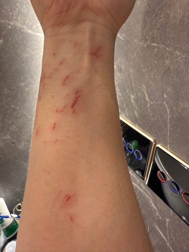 Lộ ảnh Trấn Thành bị bầm dập, tả tơi khiến fan xót xa - Ảnh 4.