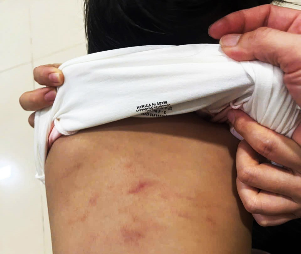 Bản tin 7/11: Làm rõ vụ cháu bé 2 tuổi nghi bị bạo hành tại lớp trông trẻ- Ảnh 1.