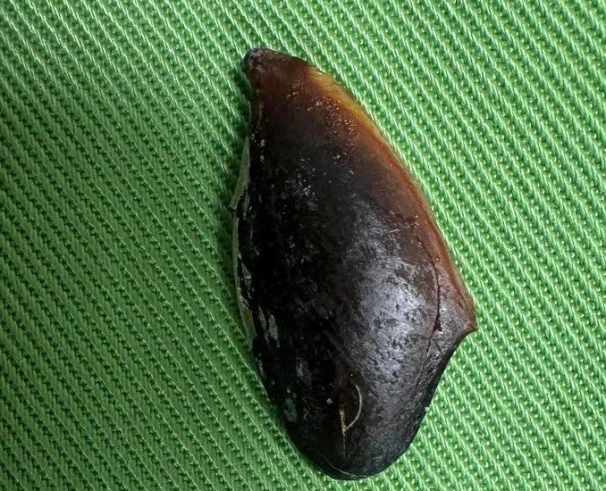 Người phụ nữ 65 tuổi ho suốt ngày, đến viện bác sĩ gắp ra thứ "đáng sợ" bên trong - Ảnh 1.