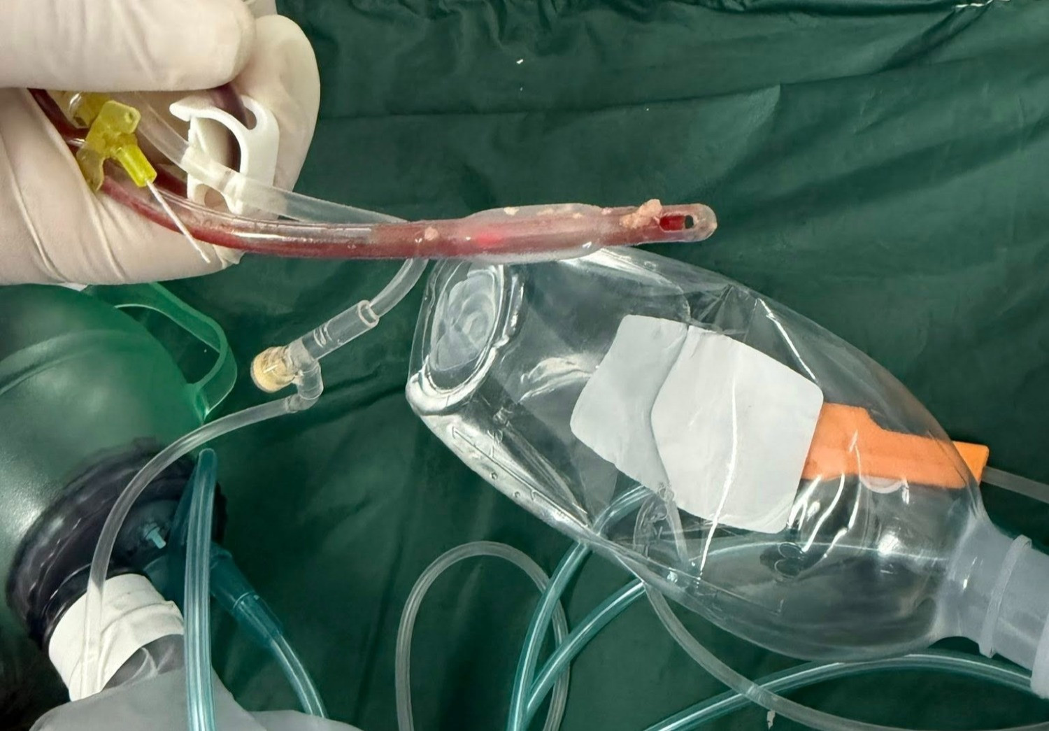 Bé gái 3 tuổi tử vong thương tâm sau khi ăn món quen thuộc này - Ảnh 1.