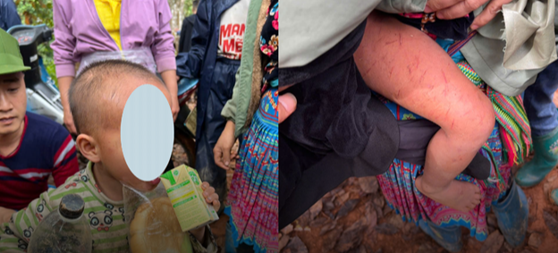 T&igrave;m thấy b&eacute; trai 4 tuổi đi lạc trong rừng cao su ở Lai Ch&acirc;u - Ảnh 1.