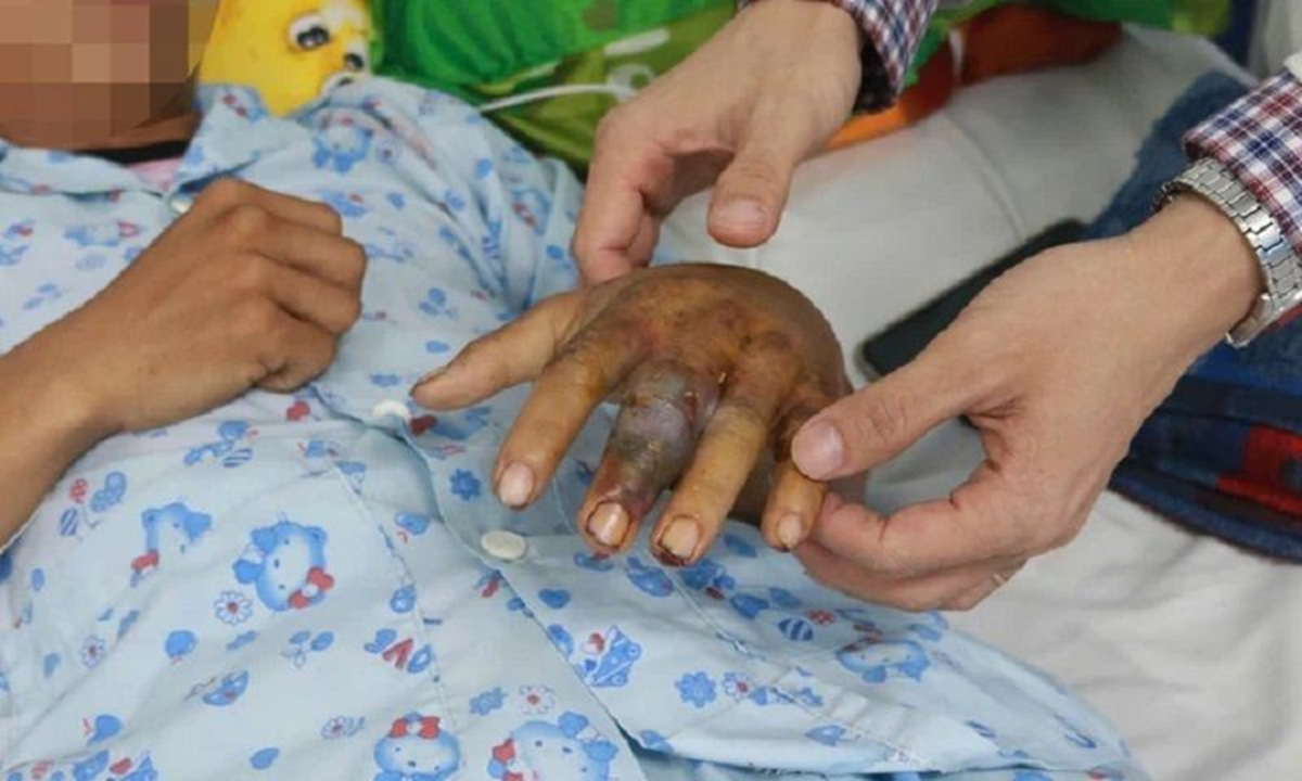 Người đàn ông 27 tuổi suýt mất mạng vì tự ý chữa bệnh theo “kiểu lạ” - Ảnh 1.