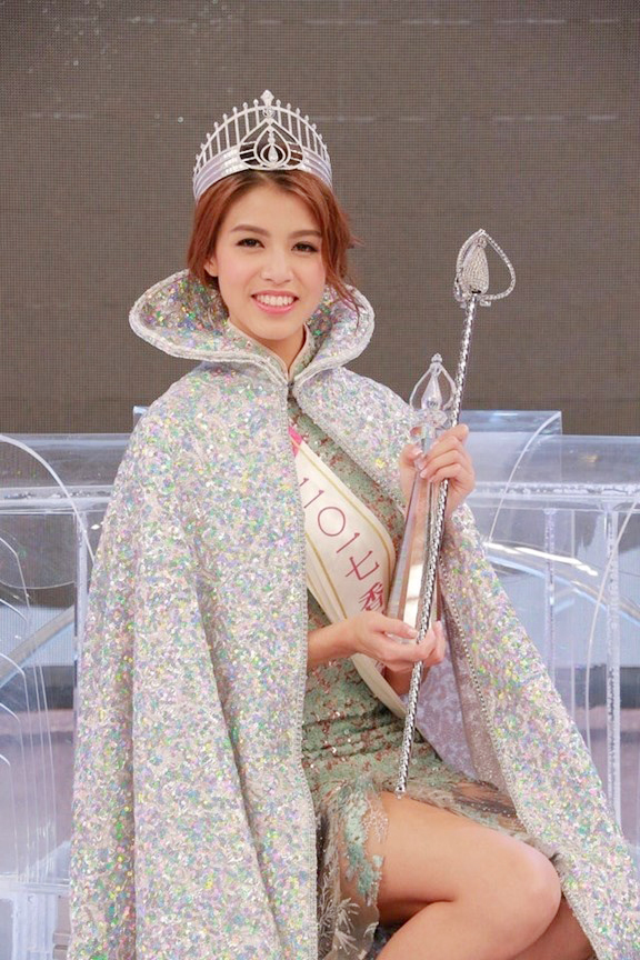 Hoa hậu xấu nhất lịch sử showbiz "lột x&aacute;c" g&acirc;y ngỡ ng&agrave;ng - Ảnh 1.