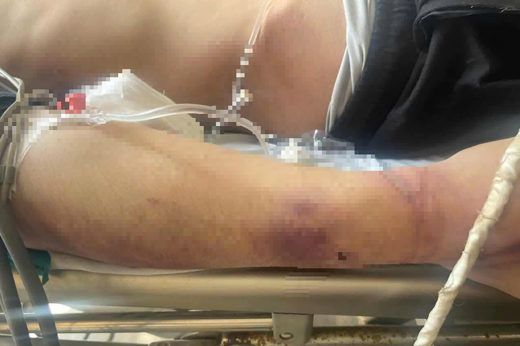 C&ocirc;ng an v&agrave;o cuộc điều tra vụ x&ocirc; x&aacute;t khiến 1 học vi&ecirc;n tử vong sau 2 ng&agrave;y nhập học- Ảnh 2.