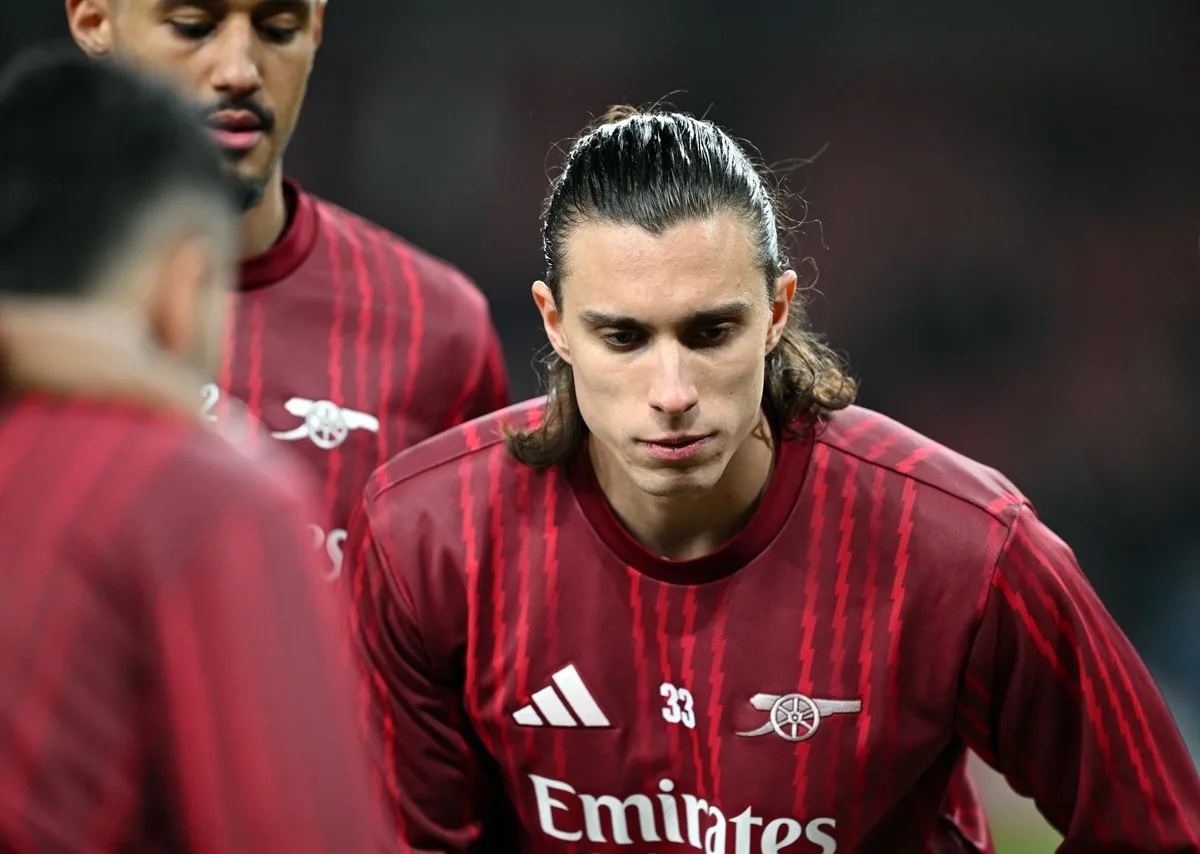 Arteta tiết lộ về các chấn thương kỳ lạ của cầu thủ Arsenal- Ảnh 1.