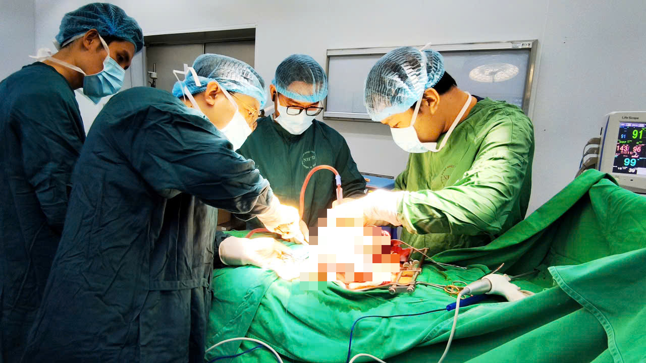 Khối u buồng trứng khổng lồ chiếm gần trọn bụng dưới của bệnh nhân 20 tuổi- Ảnh 2. Khối u buồng trứng khổng lồ chiếm gần trọn bụng dưới của bệnh nhân 20 tuổi- Ảnh 2.