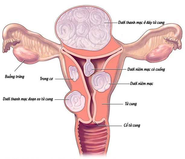 Điều gì khiến nhiều đại lý, hiệu thuốc muốn phân phối Ago Tumor?- Ảnh 1.