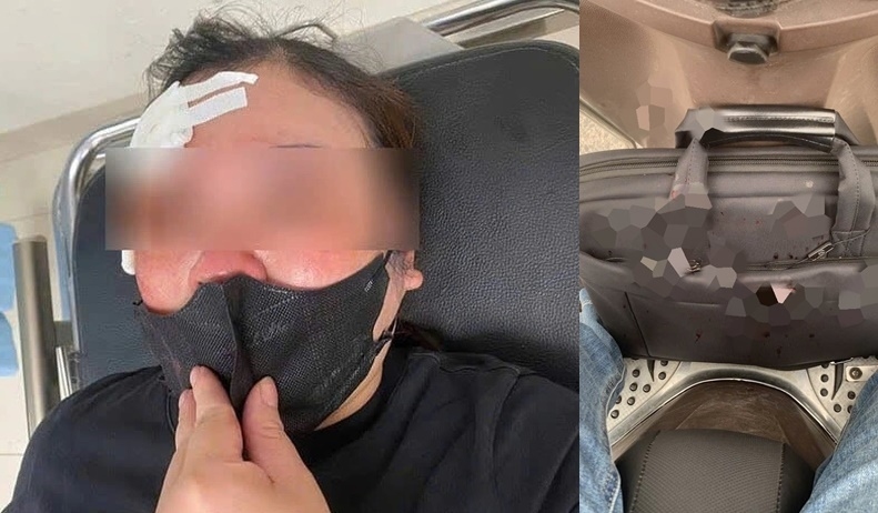 Nguyên nhân vụ người phụ nữ đi xe máy bị đánh vào đầu ở Hà Nội- Ảnh 1. Nguyên nhân vụ người phụ nữ đi xe máy bị đánh vào đầu ở Hà Nội- Ảnh 1.