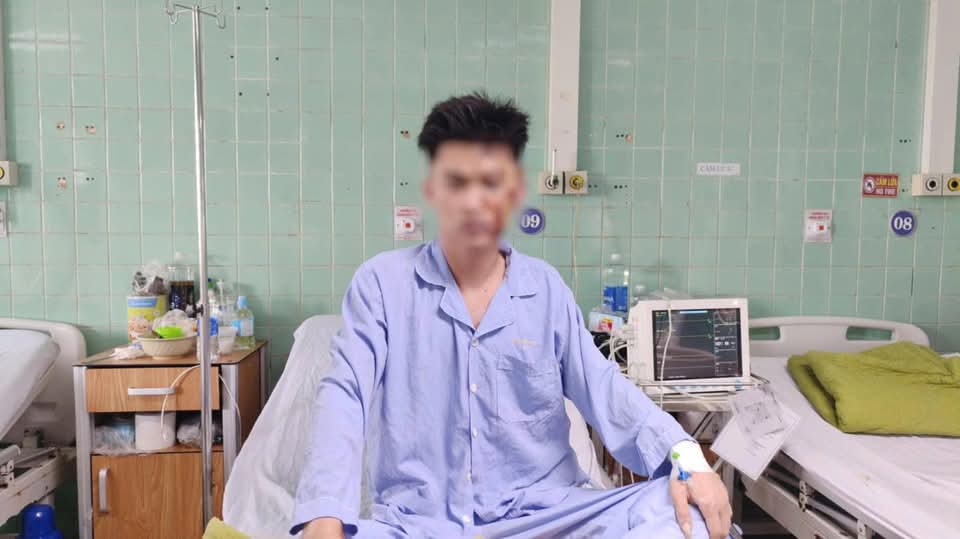 Nam thanh niên sống sót thần kỳ sau khi bị thanh gỗ đâm sâu 20cm vào ngực- Ảnh 3. Nam thanh niên sống sót thần kỳ sau khi bị thanh gỗ đâm sâu 20cm vào ngực- Ảnh 3.