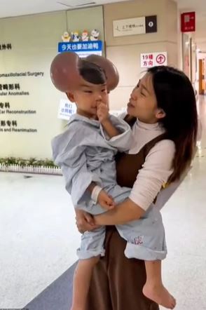Cậu bé 3 tuổi với phần đầu lồi lên bất thường và sự thật đau lòng phía sau- Ảnh 1. Cậu bé 3 tuổi với phần đầu lồi lên bất thường và sự thật đau lòng phía sau- Ảnh 1.