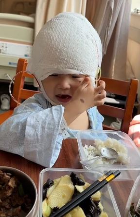 Cậu bé 3 tuổi với phần đầu lồi lên bất thường và sự thật đau lòng phía sau- Ảnh 2. Cậu bé 3 tuổi với phần đầu lồi lên bất thường và sự thật đau lòng phía sau- Ảnh 2.
