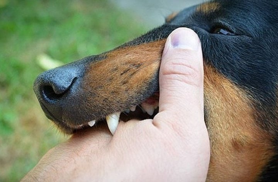 Bé trai 13 tuổi nguy kịch sau 2 tháng bị chó cắn vì sai lầm này của người thân- Ảnh 1.