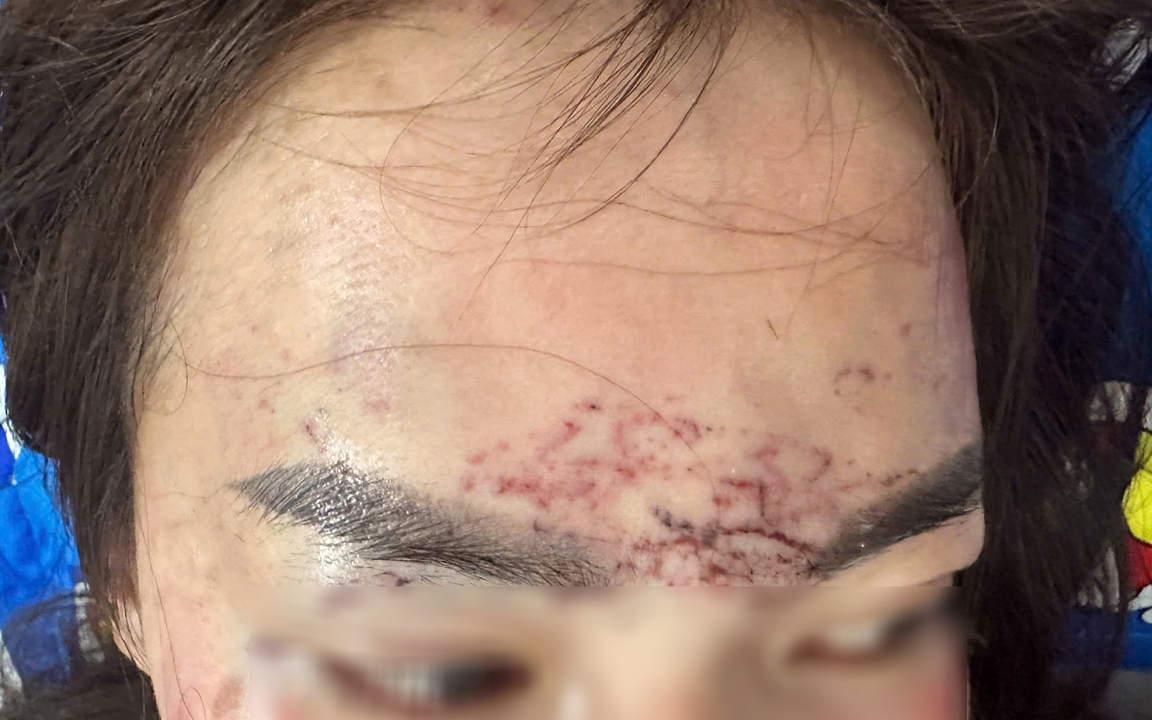 Khởi tố vụ người phụ nữ bị cắt tóc, xăm trán, đánh đập gây thương tích để điều tra