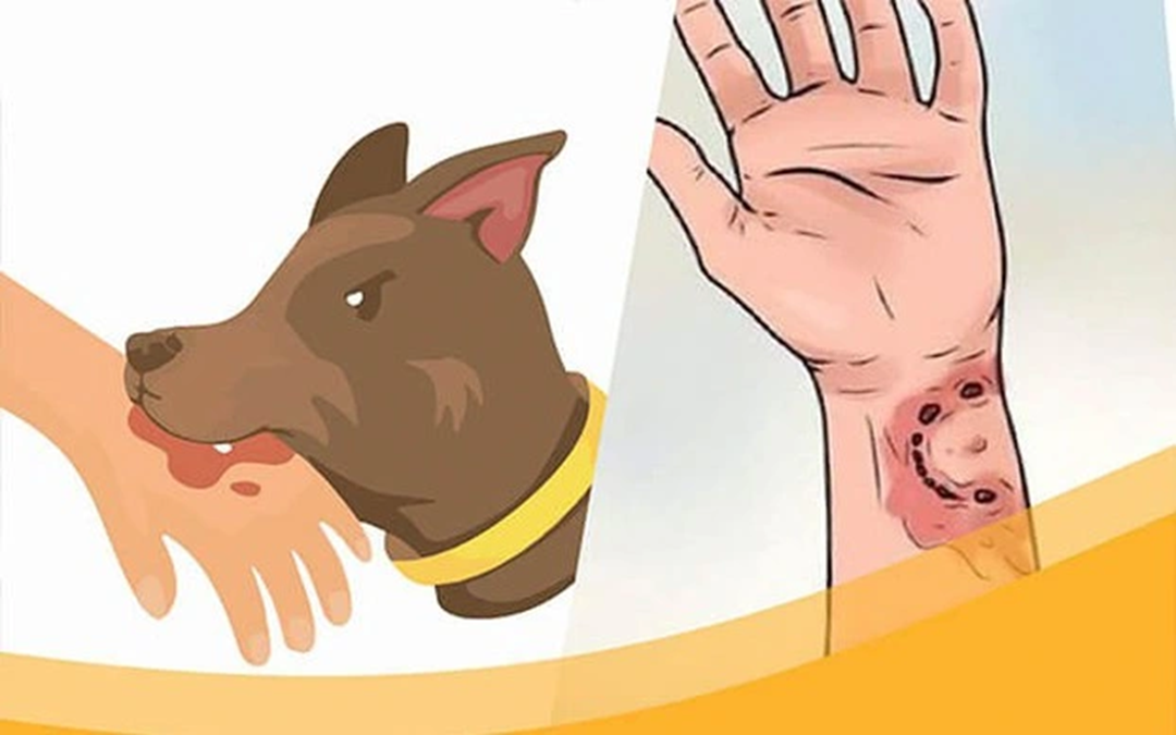 Người đàn ông tử vong sau 2 tháng bị chó lạ cắn- Ảnh 1. Người đàn ông tử vong sau 2 tháng bị chó lạ cắn- Ảnh 1.