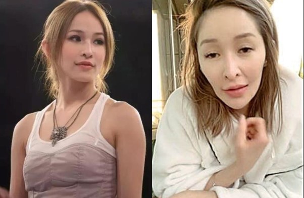 Sốc nặng trước diện mạo biến dạng của nữ diva nổi tiếng sau vụ bị chó cắn đến hủy dung- Ảnh 3. Sốc nặng trước diện mạo biến dạng của nữ diva nổi tiếng sau vụ bị chó cắn đến hủy dung- Ảnh 3.
