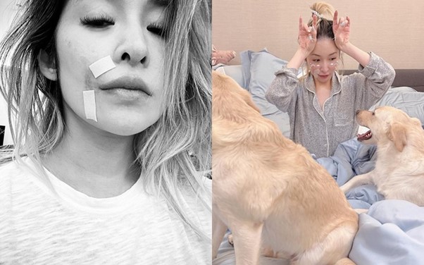 Sốc nặng trước diện mạo biến dạng của nữ diva nổi tiếng sau vụ bị chó cắn đến hủy dung- Ảnh 4. Sốc nặng trước diện mạo biến dạng của nữ diva nổi tiếng sau vụ bị chó cắn đến hủy dung- Ảnh 4.
